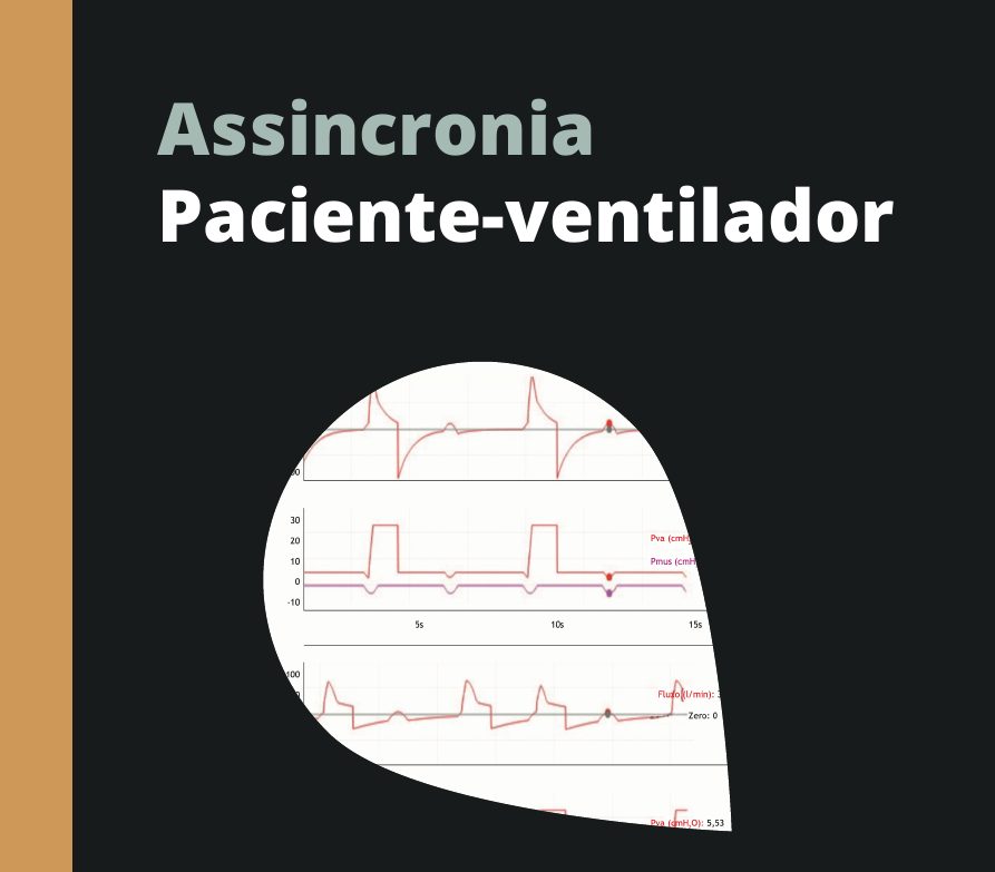 Capa do eBook Assincronia Paciente-Ventilador