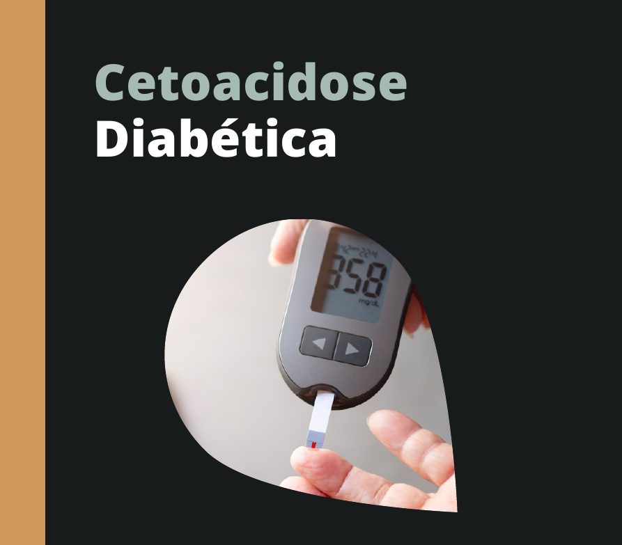 Capa do eBook Cetoacidose Diabética