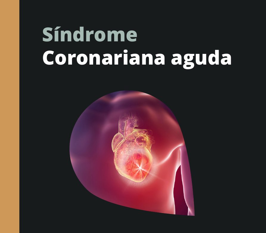 Capa do eBook Síndrome Coronariana Aguda